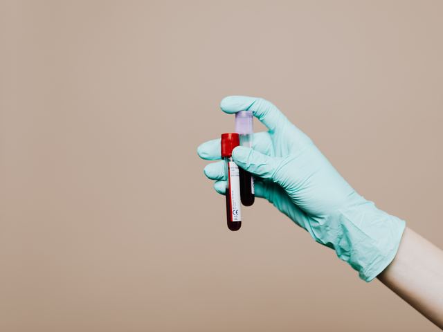 A gloved hand holding two filled blood sample tubes.